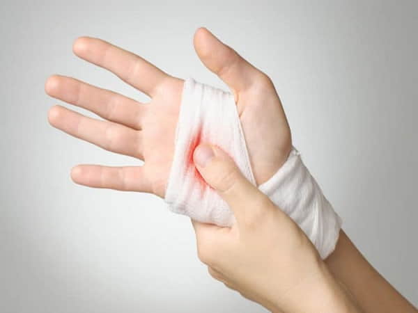 Mơ thấy mình bị đứt tay chảy máu