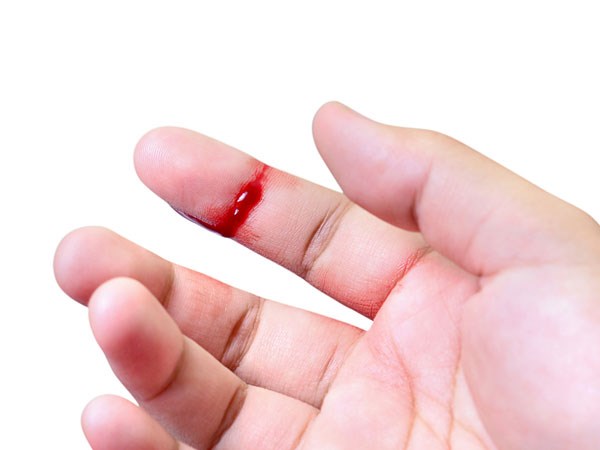 Nằm mơ thấy chảy máu tay đánh con gì - Ý nghĩa mộng chảy máu tay