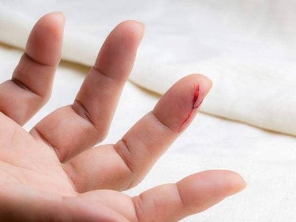 Nằm mơ thấy đứt tay chảy máu là điềm báo gì? Chọn số mấy